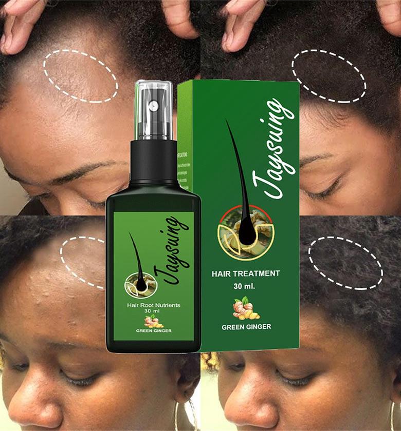 Anti-Hair Loss Tonic Hair Treatment image